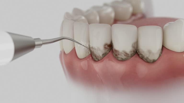 Reliable Dental contractor in Dover, TN by Dentist Open Now